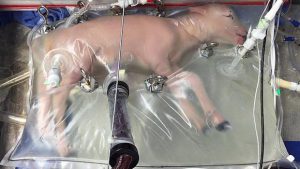 El útero artificial que podría salvar a bebés prematuros. Foto: Euronews.