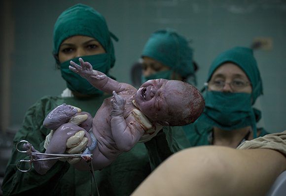 El trabajo unificado entre el Centro de Inmunoensayo y el sistema de salud pública en Cuba, garantizan el nacimiento de niños sanos. Foto: Irene Pérez/ Cubadebate.